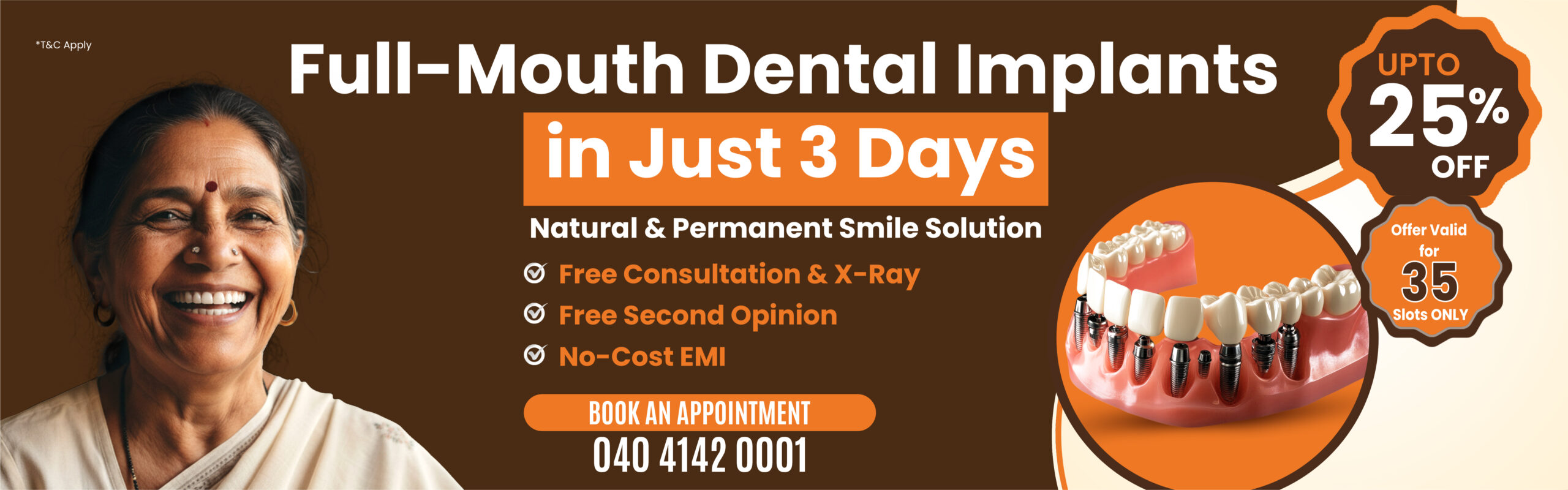 Save Up to 25% off on Full-Mouth Dental Implants